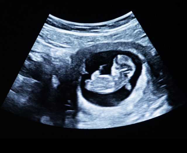 about us sonography