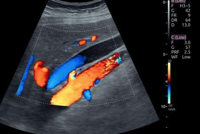Color Doppler Scan in Pune