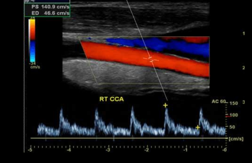 Color Doppler Scan in Pune