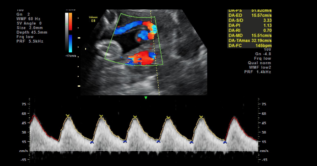 Color Doppler Scan in Pune